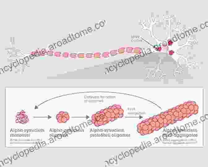 A Microscopic Image Of Protein Aggregates In A Brain Cell Protein Folding: An (SpringerBriefs In Molecular Science)