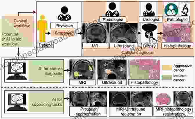 AI Powered Prostate Cancer Screening Using MRI Images Ai In Prostate Cancer: A Guide On Ai And Its Added Advantage To Prostate Cancer