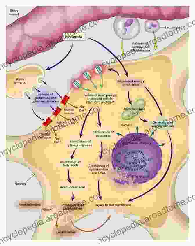 Cellular Pathophysiology Of Cerebral Ischemia Cerebral Ischemia: Molecular And Cellular Pathophysiology (Contemporary Neuroscience)