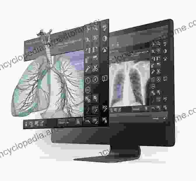 Computer Screen Displaying Medical Imaging Software Used For Image Processing Essentials Of Radiographic Physics And Imaging E