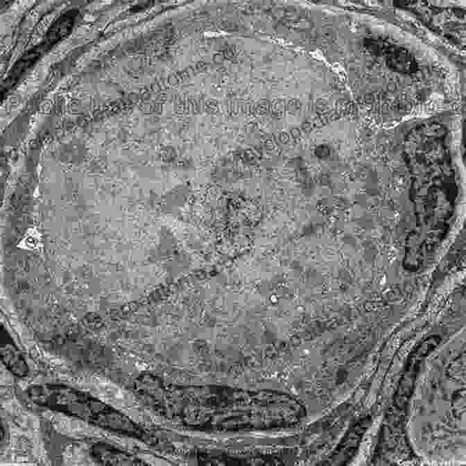 Electron Microscopy Image Of The Ovary, Revealing Its Intricate Cellular Structure. Ultrastructure Of The Ovary (Electron Microscopy In Biology And Medicine 9)