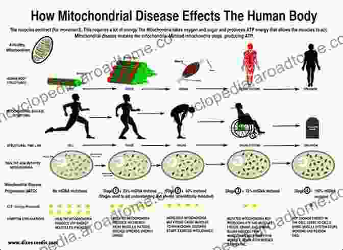 Image Showing Individuals Affected By Mitochondrial Diseases Cellular And Molecular Basis Of Mitochondrial Inheritance: Mitochondrial Disease And Fitness (Advances In Anatomy Embryology And Cell Biology 231)