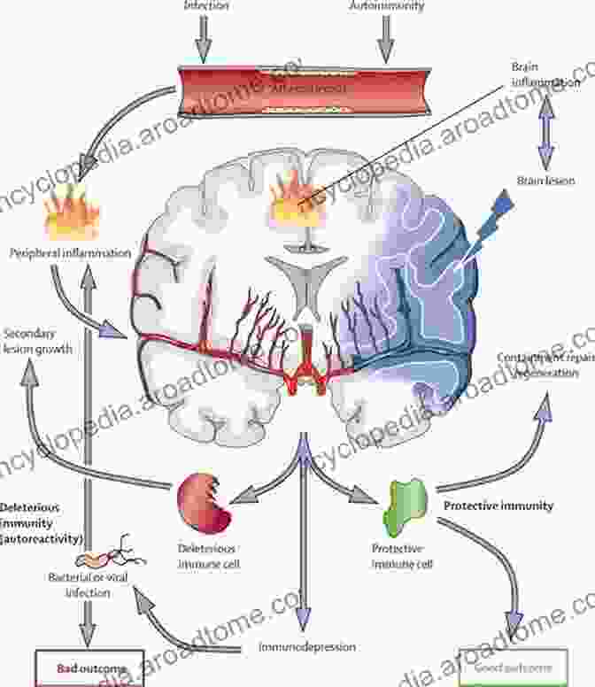 Molecular Mechanisms Of Cerebral Ischemia Cerebral Ischemia: Molecular And Cellular Pathophysiology (Contemporary Neuroscience)