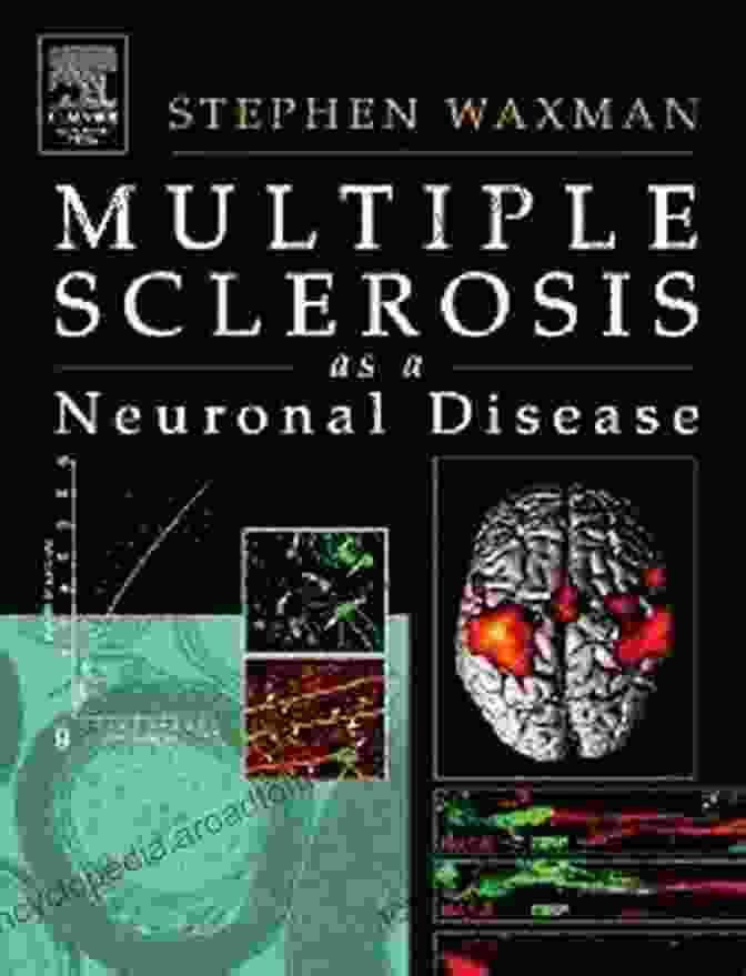 Multiple Sclerosis As Neuronal Disease Book Cover Multiple Sclerosis As A Neuronal Disease