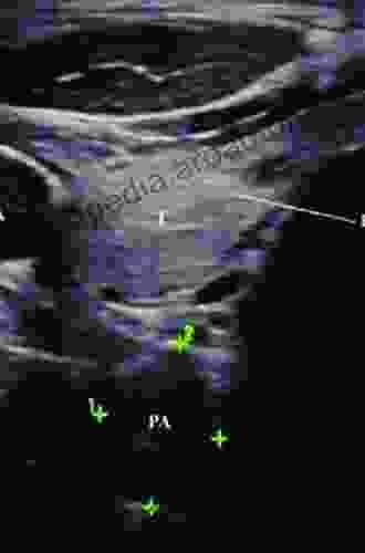 Advanced Thyroid and Parathyroid Ultrasound