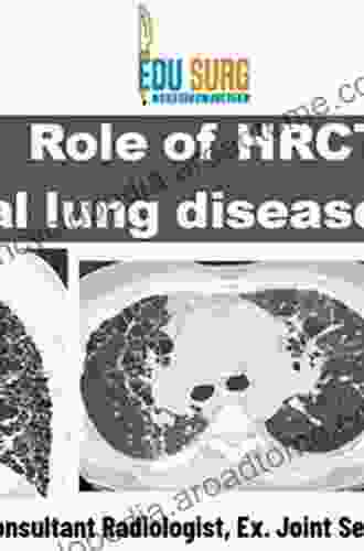 HRCT In Interstitial Lung Disease: Instructive Case Studies