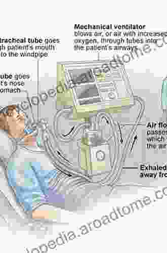 Mechanical Ventilation In Emergency Medicine