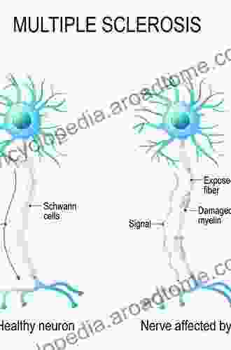 Multiple Sclerosis As A Neuronal Disease